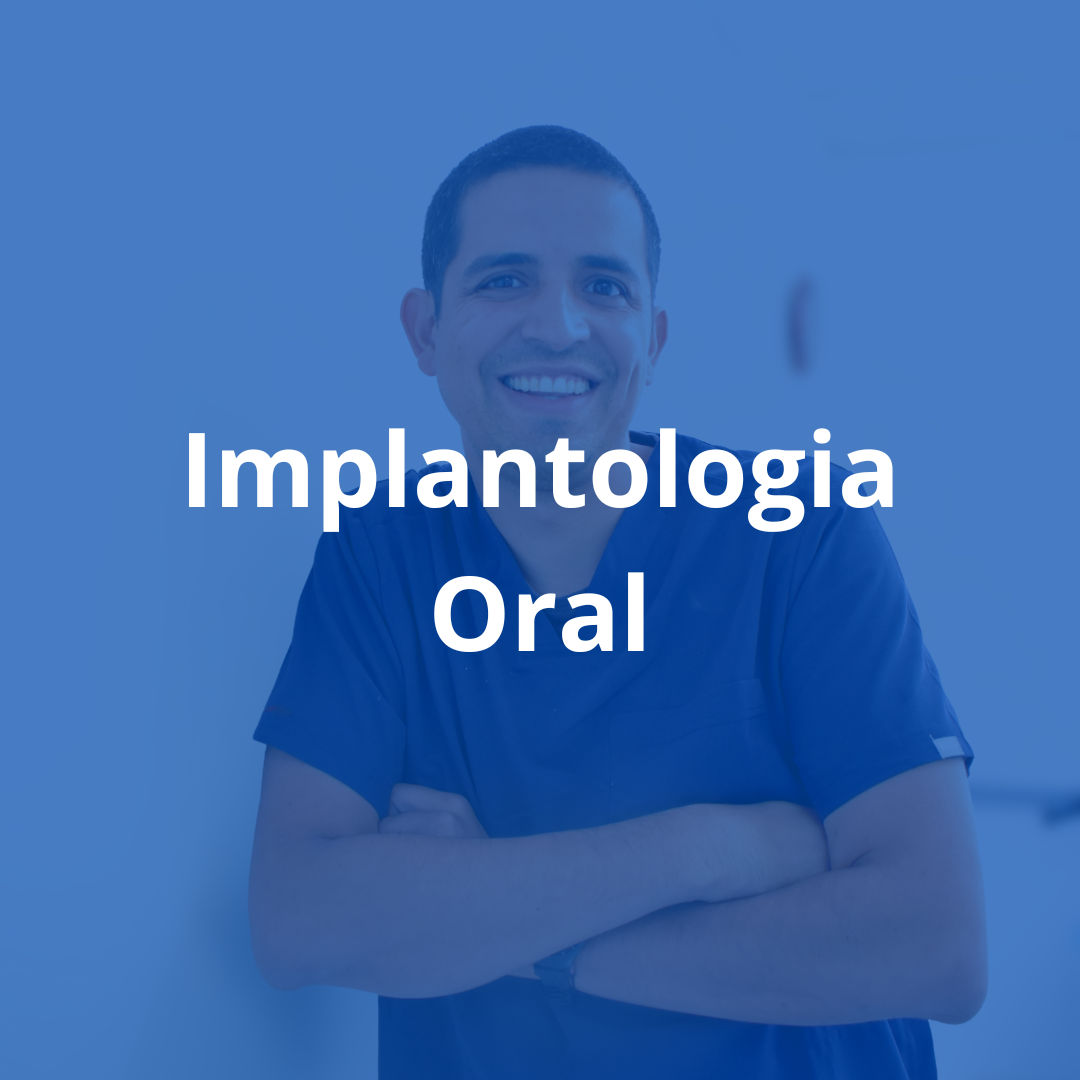 La solución ideal para recuperar tu sonrisa